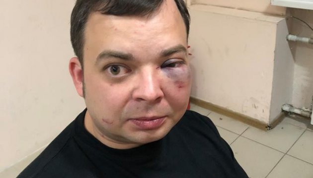 В Киеве сына Шуфрича избили "сотрудники органов" 