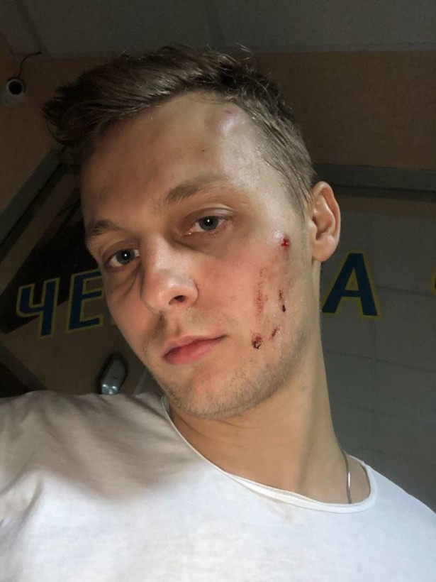 В Киеве сына Шуфрича избили "сотрудники органов" 