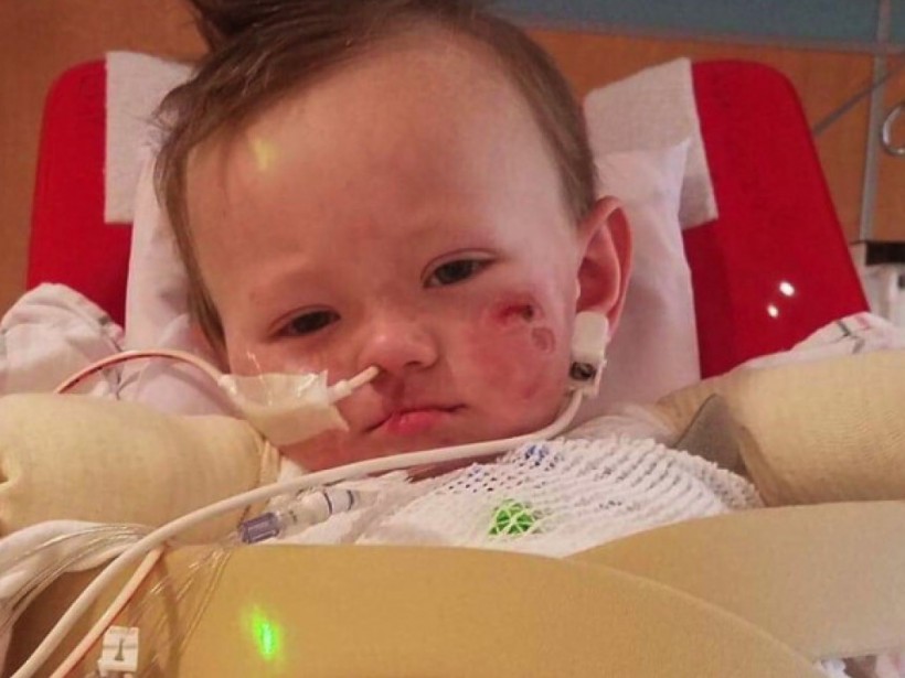 Двухлетнему малышу из многодетной семьи из-за редкой инфекции ампутировали руки и ноги (ФОТО) Двухлетнему малышу из многодетной семьи из-за редкой инфекции ампутировали руки и ноги (ФОТО)