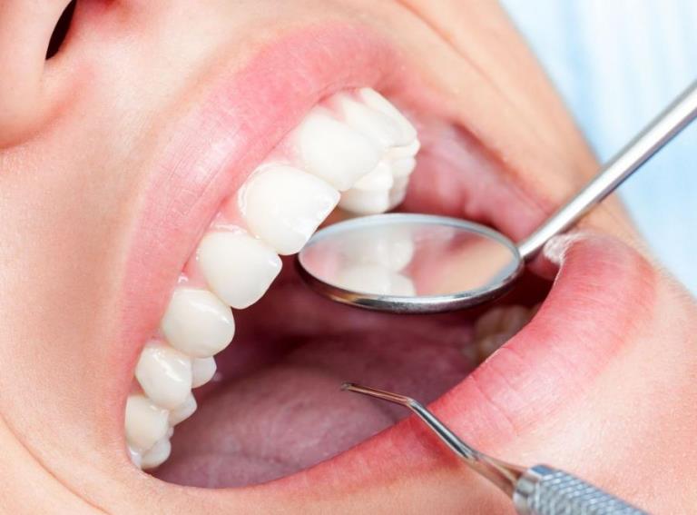 наиболее распространенные заболевания зубов