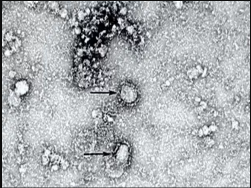 Неизвестный тип коронавируса под микроскопом