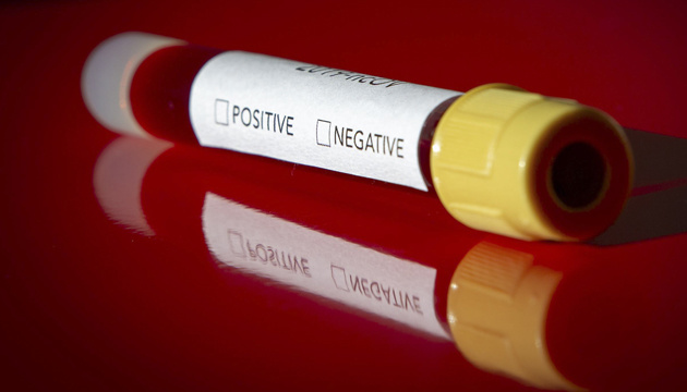 Минздрав: коронавирус обнаружили у пятерых украинцев, все - за рубежом Минздрав: коронавирус обнаружили у пятерых украинцев, все - за рубежом