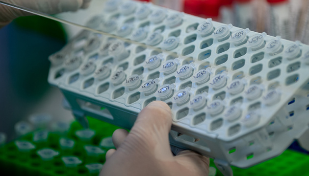 Украинские ученые изготовили первую партию экспресс-тестов Украинские ученые изготовили первую партию экспресс-тестов