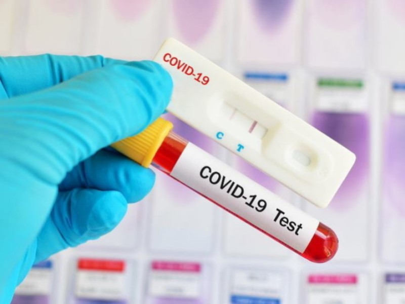 Тесты на коронавирус