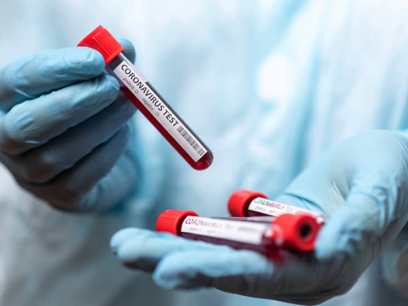 Тест на коронавирус