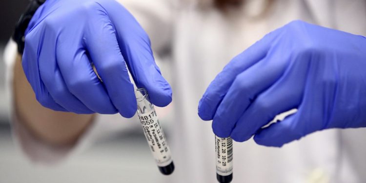 Штамм коронавируса "Омикрон"