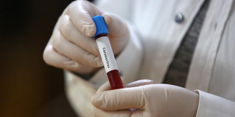 Тест на коронавирус