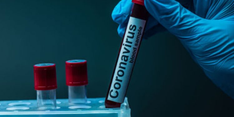 Тест на коронавирус