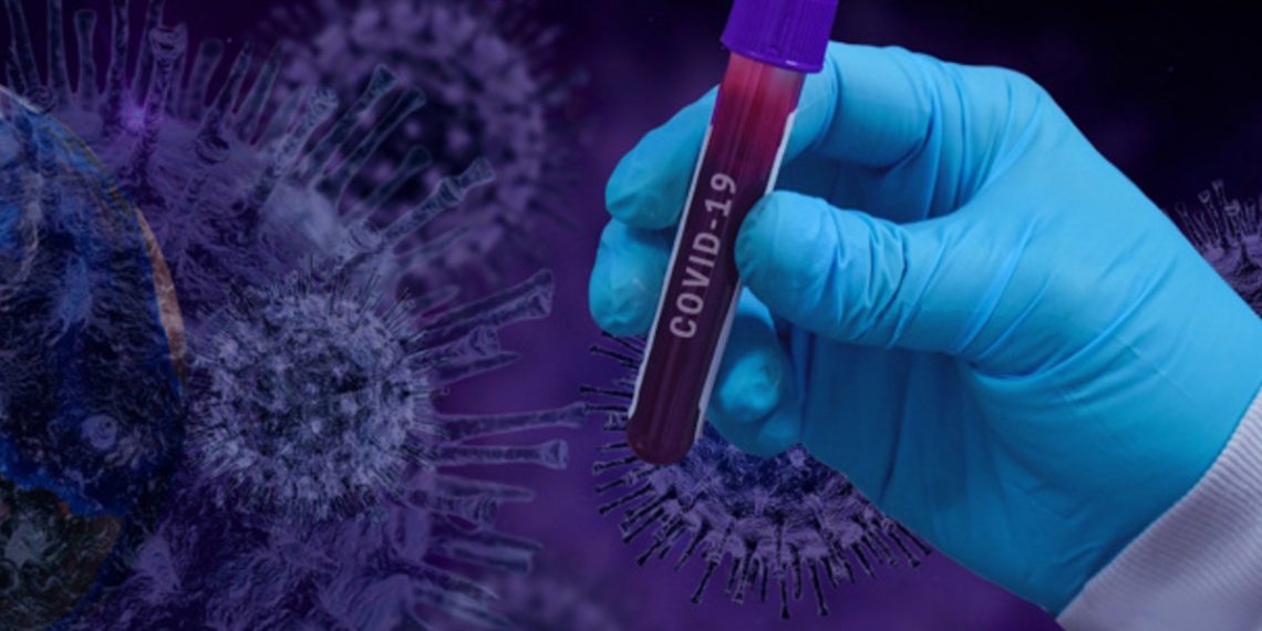 Пандемия COVID-19