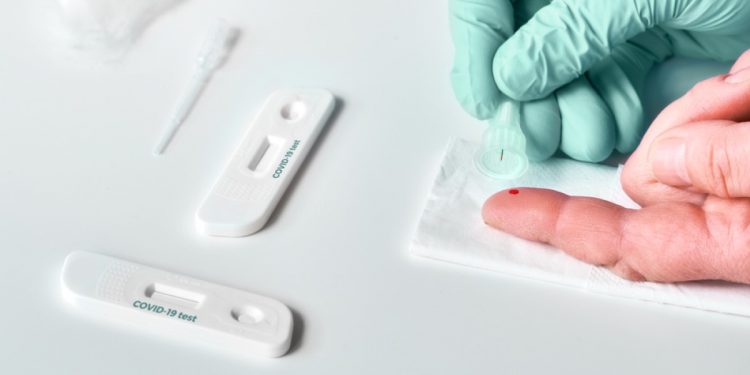 Тест на коронавирус