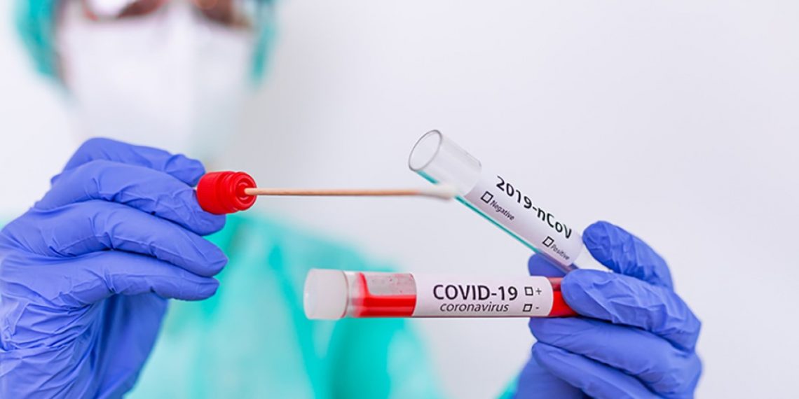 Тест на коронавирус