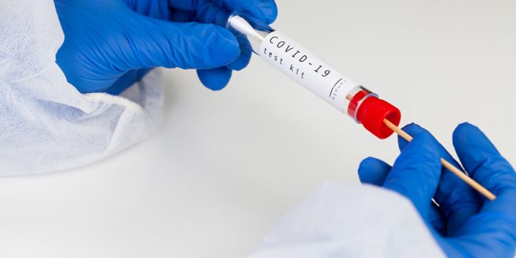 Тест на коронавирус