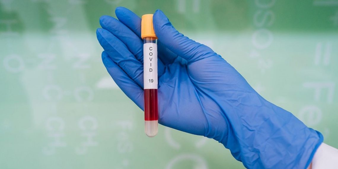 Коронавирус