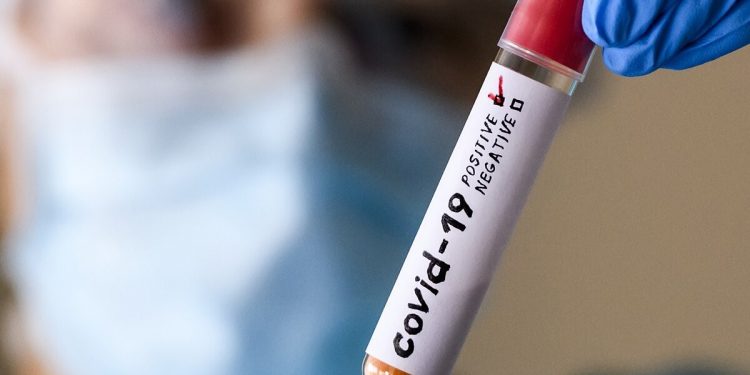 Тест на коронавирус