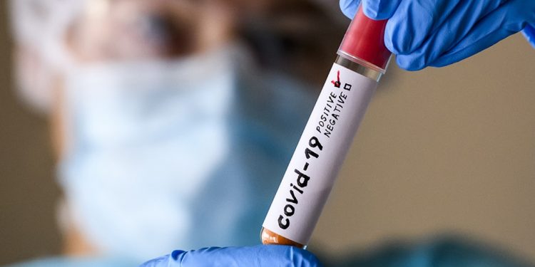 Тест на коронавирус