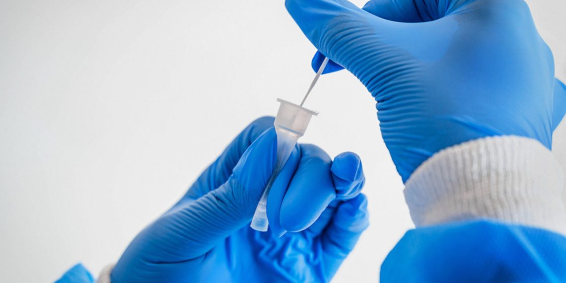 Исследование коронавируса