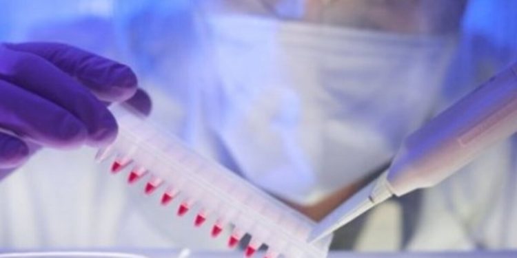 Неизвестная инфекция