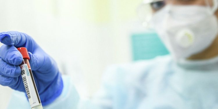 Тест на коронавирус