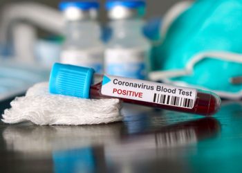 Тест на коронавирус