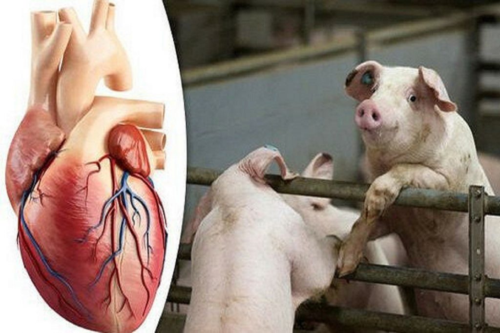 Человек живет с сердцем свиньи: в США впервые в мире пересадили пациенту сердце животного