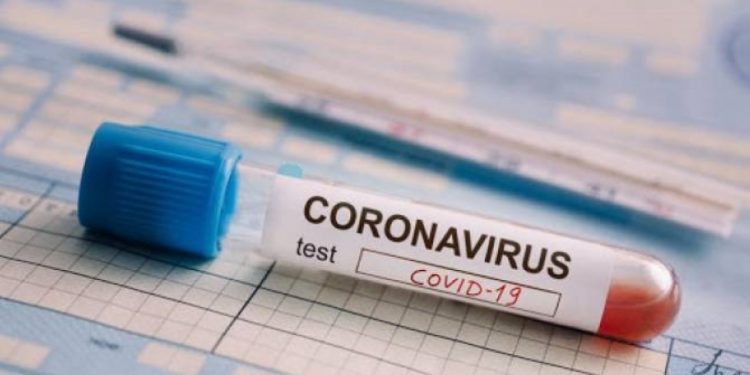 Тест на коронавирус