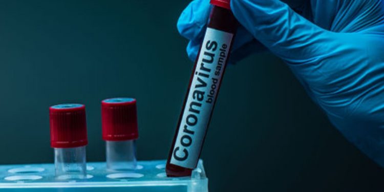 Тест на коронавирус