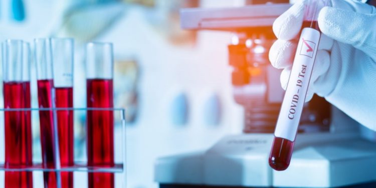 Пандемия коронавируса