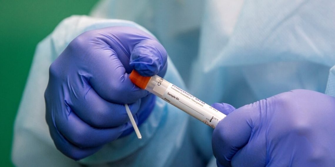 Исследование коронавируса