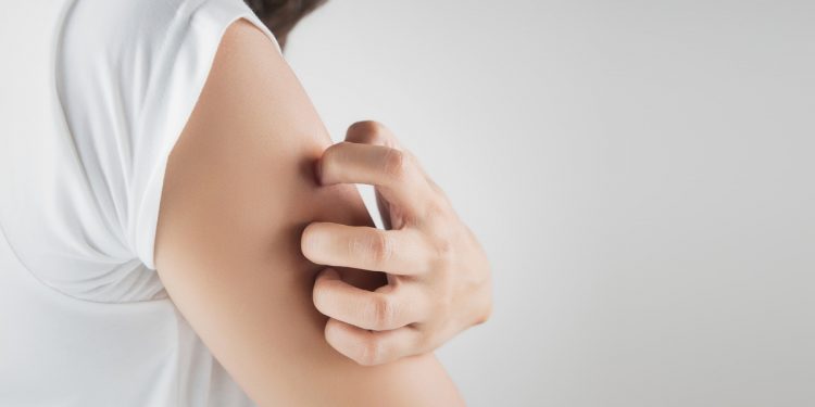 Зуд от высыпания на коже