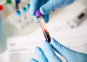 Исследование крови