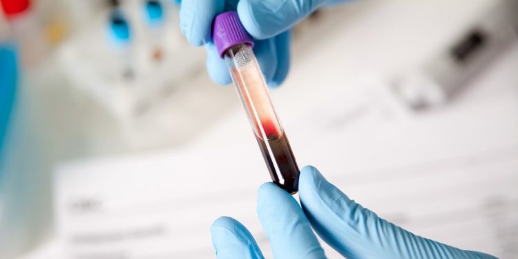 Исследование крови