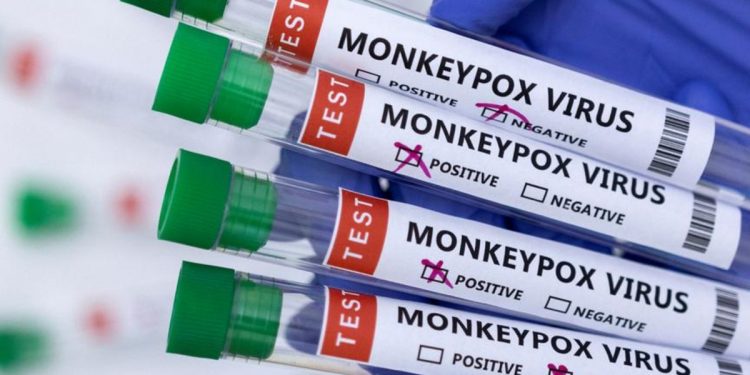 Обезьянья оспа