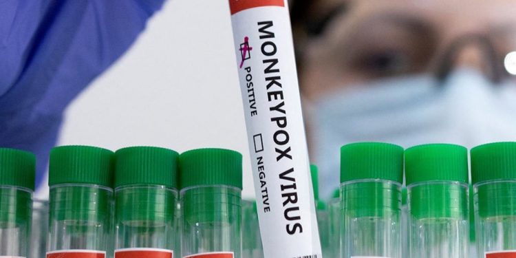 Мавпяча віспа