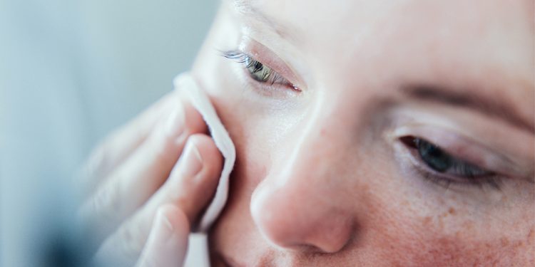 Как стресс влияет на кожу