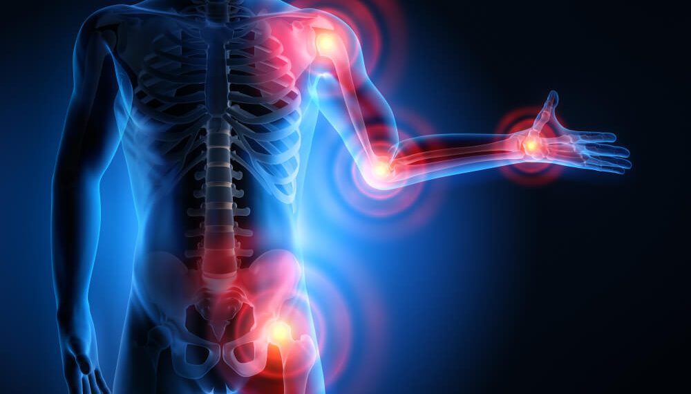 Боль в суставах