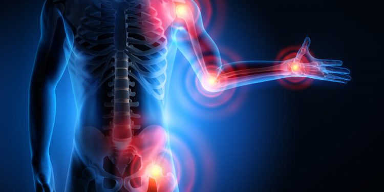 Боль в суставах