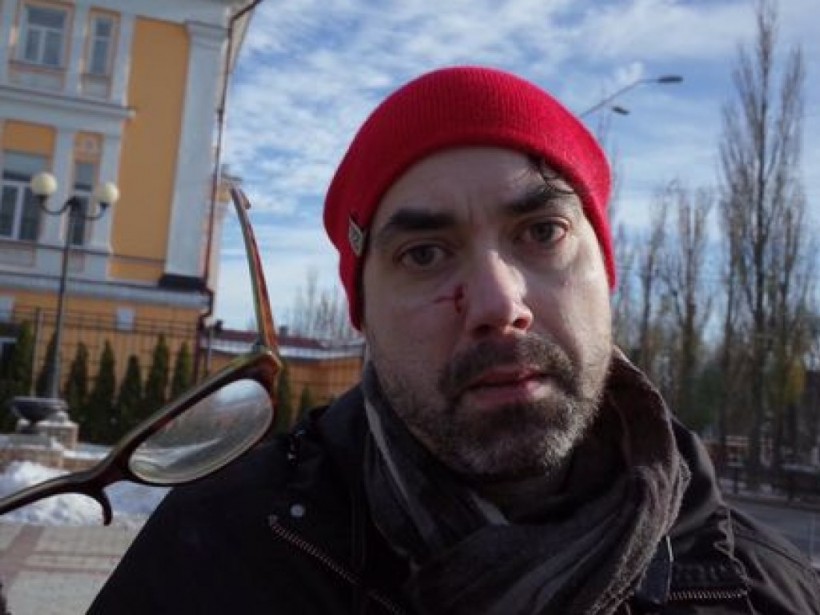 В Киеве избили канадского журналиста (ФОТО)
